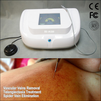 China High Frequency Vascular Removal/Spider Veins Removal supplier