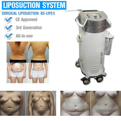 China BS-LIPS5 PAL Liposuction fat reduce PAL body slimming surgical liposuction supplier