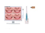 Medical Set Oral Camera + Film Viewer Reader + USB Disk Set Option WIFI For Teeth Treatment Dental Chair Spare Parts CX-
