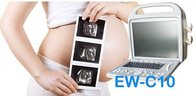 Portable ultrasound machine EW-C10V with Convex probe C3R60 and Linear probe L7L40 for mix practice animals