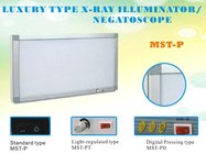 Veterinary Medical x-ray illuminator,film viewer box,negatoscope MST-P standard single union