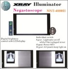 LED X-ray Illuminator, X-ray Film Viewer Box, X-Rary Negatoscope Mst-4000II Double Union Minston Medical Light
