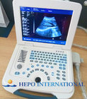 diagnosis equipment portable 2D 12 inch monitor ultrasound scanner for medical