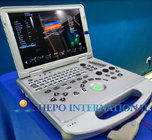portable CW function 3D ultrasound scanner for cardiac for hospital