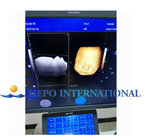 15" monitor Digital ultrasound machine with 3D software trolley scanner