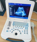 CE certification white portable 2D ultrasound scanner with battery in medical instrument