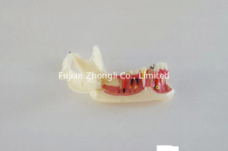 China Dental Half Lower Jaw Open Gum Bone Pathological Diseases supplier