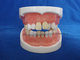 typodent dental jaw model for practice extract tooth supplier
