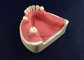 medical science dental implant model with soft gingiva supplier