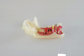 Dental Half Lower Jaw Open Gum Bone Pathological Diseases supplier