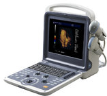 Hot sale! Full Digital Color Doppler Ultrasonic Diagnostic Equipment