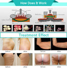 CE approval cellulite removal velashape vacuum roller shape and slim machine