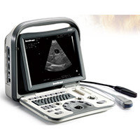China Portable veterinary Sonoscape Ultrasound a6v supplier