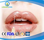 Plump Lips Implant of Hyaluronic Acid Gel Injection 2ml of Derm Deep Kind