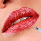 Plump Lips Implant of Hyaluronic Acid Gel Injection 2ml of Derm Deep Kind