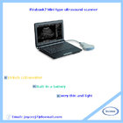 PC based Mini type ultrasound scanner low price