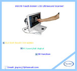 Touch Screen Black and White Ultrasound Scanner with 3D function