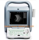 Ce/ISO Approved Medical Ophthalmic Ultrasound Ultrasonic a/B Scan for Ophthalmology