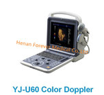 Ce Medical Equipment 3D 4D Hand-Held Portable Color Doppler Ultrasound