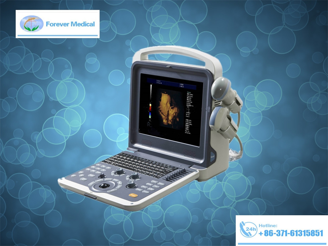 Medical Device Full Digital Color Doppler Ultrasound Scanner (YJ-U60)