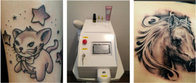 Mini 1064 / 532nm Q switched nd yag laser for tattoo removal machine