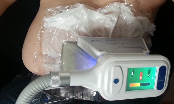 2016 hot sell cryolipolysis body slimming machine/ cryolipolysis membrane